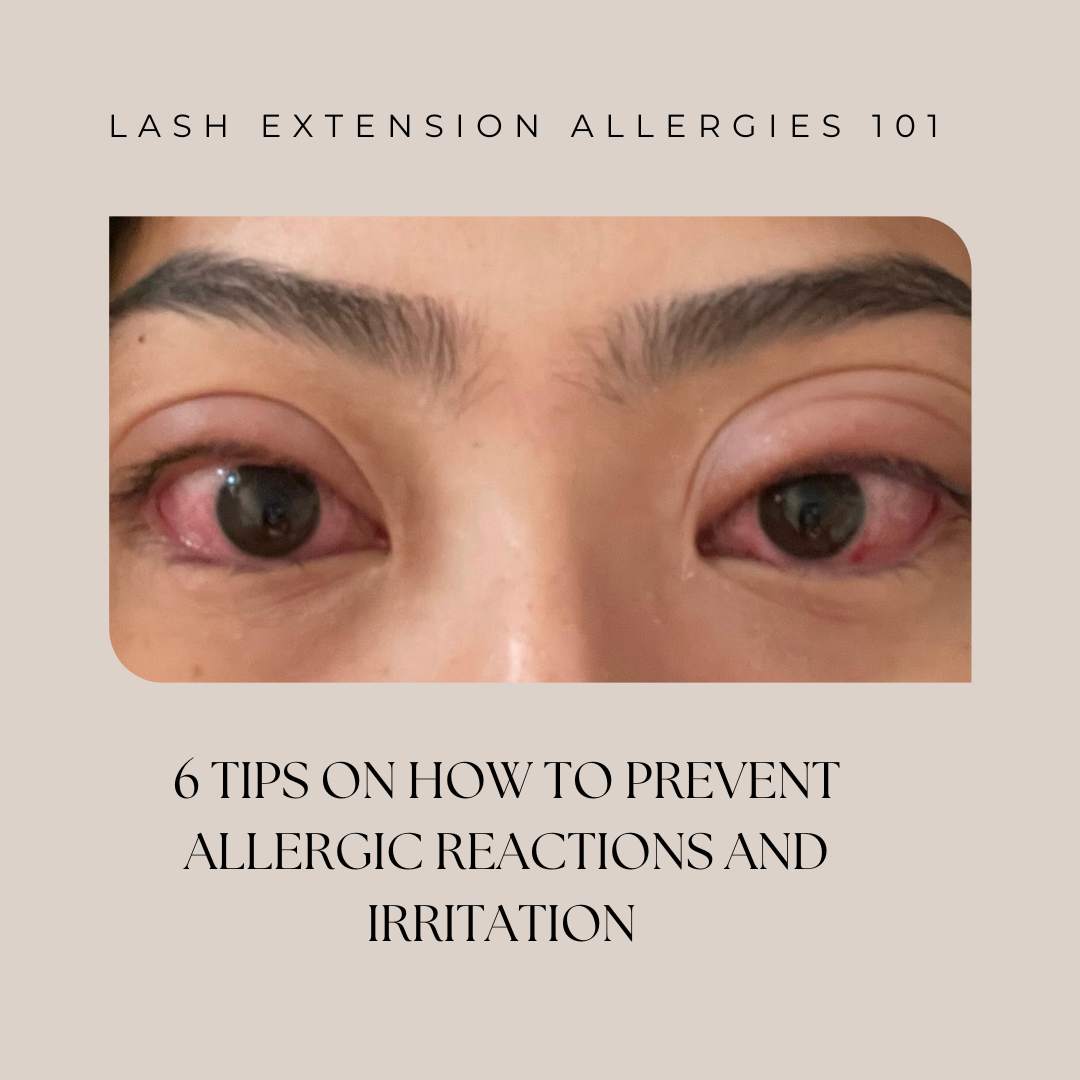 PREVENTING ALLERGIC REACTIONS
