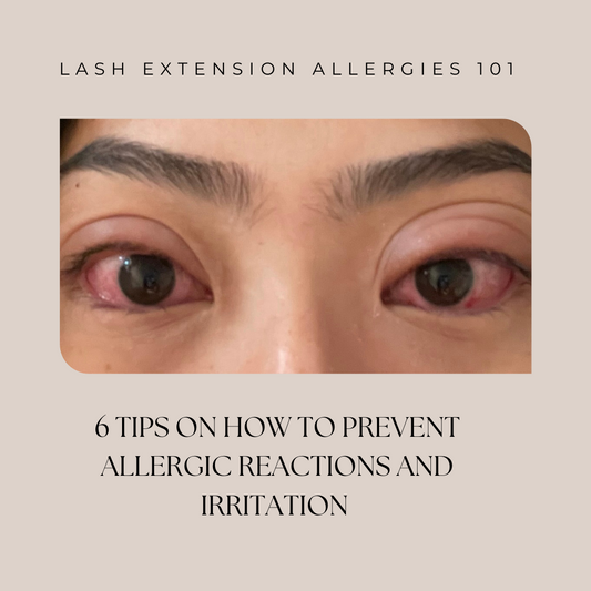 PREVENTING ALLERGIC REACTIONS